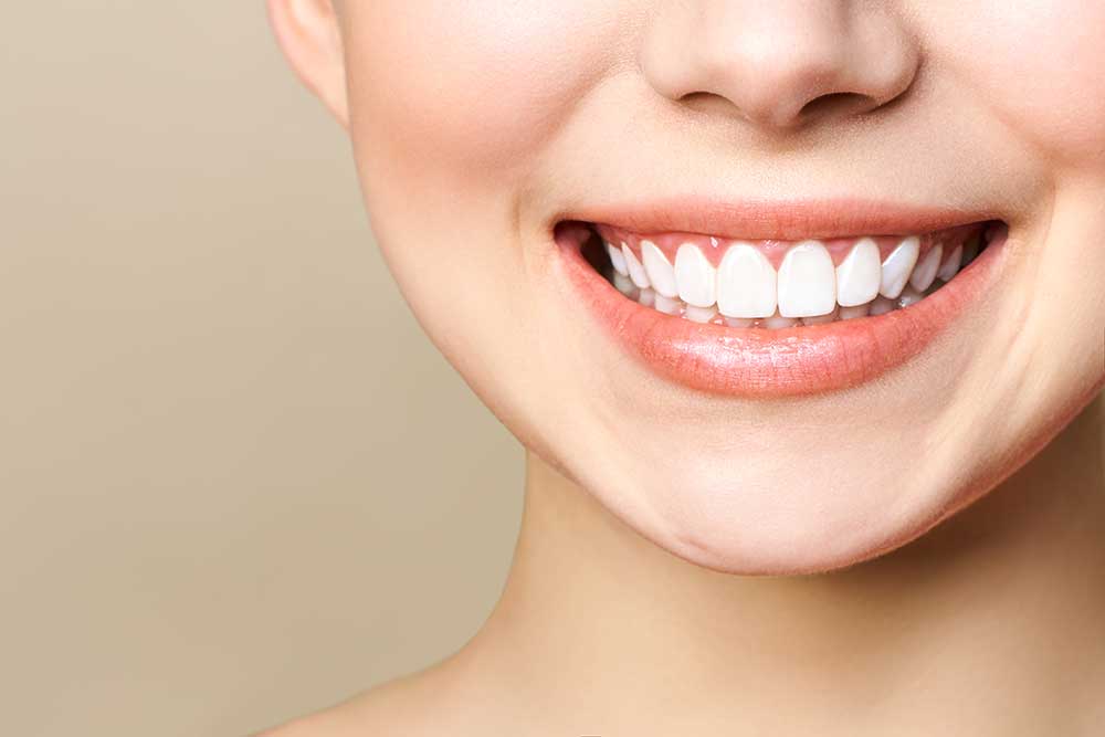 Fluoride Treatments