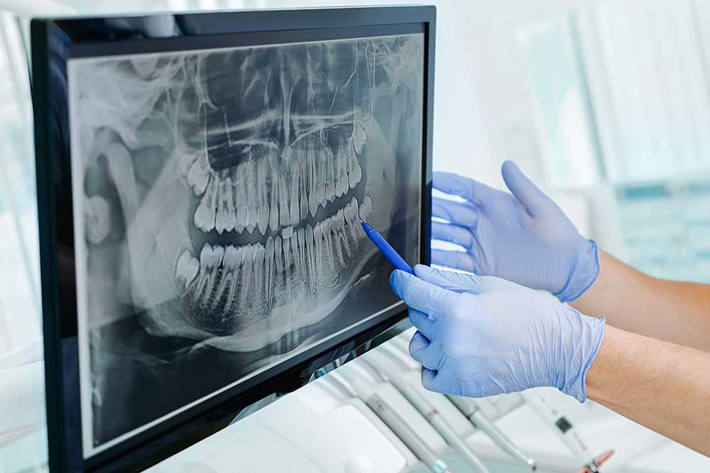 X-Rays